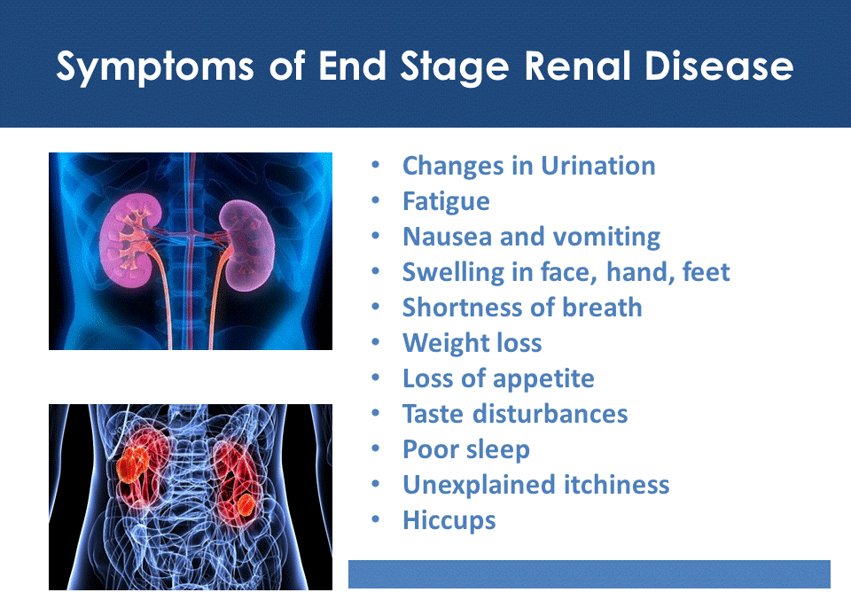 end stage kidney disease