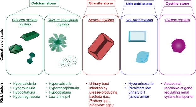 Kidney Stone Crystals