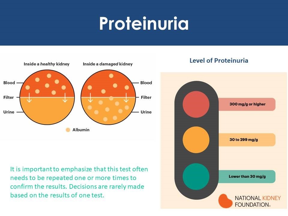 Proteinuria, Hematuria, Edema