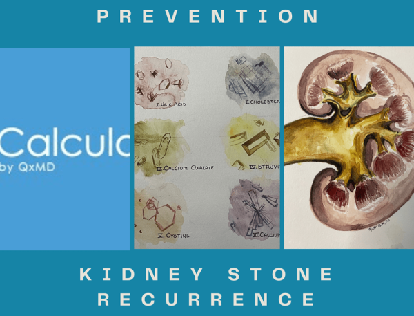 nephroliths kidney stone recurrence
